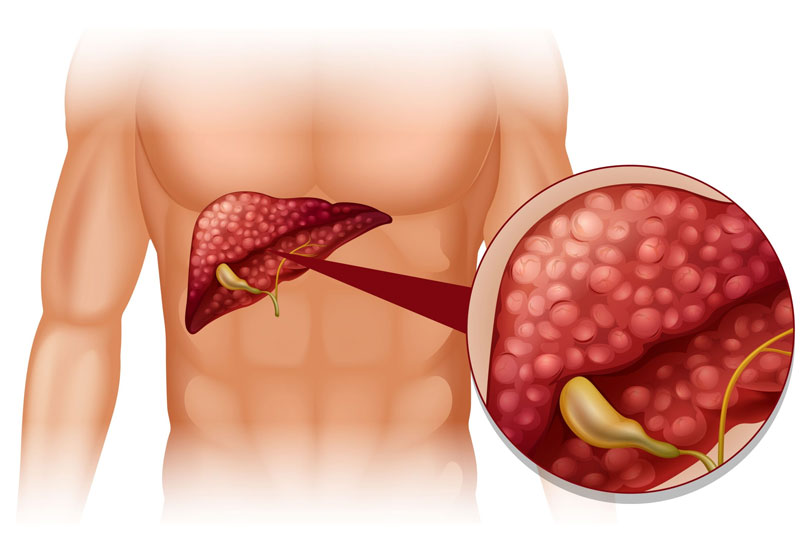 Bariatric surgery in Novi, Michigan