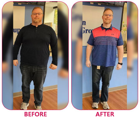 Gastric bypass surgery Novi, Michigan