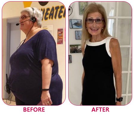 Best bariatric surgeon Novi, Michigan